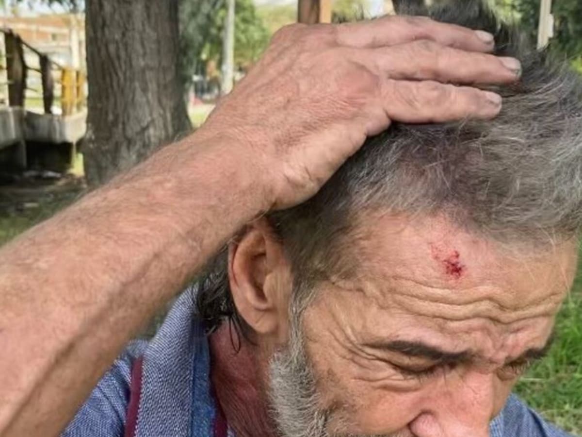Denuncian presunto caso de maltrato a habitante de calle en un desalojo