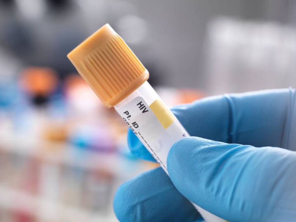 Lucha contra el sida se debilita por la pandemia del COVID-19: ONUSIDA