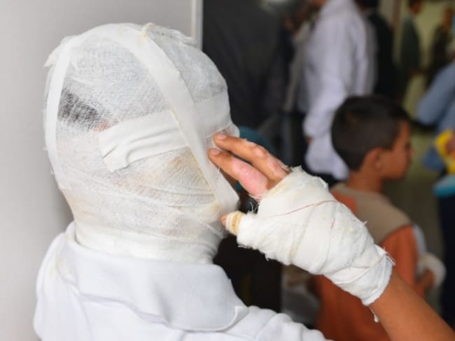 Con nueve casos nuevos, aumentó a 27 la cifra de quemados con pólvora en el Tolima