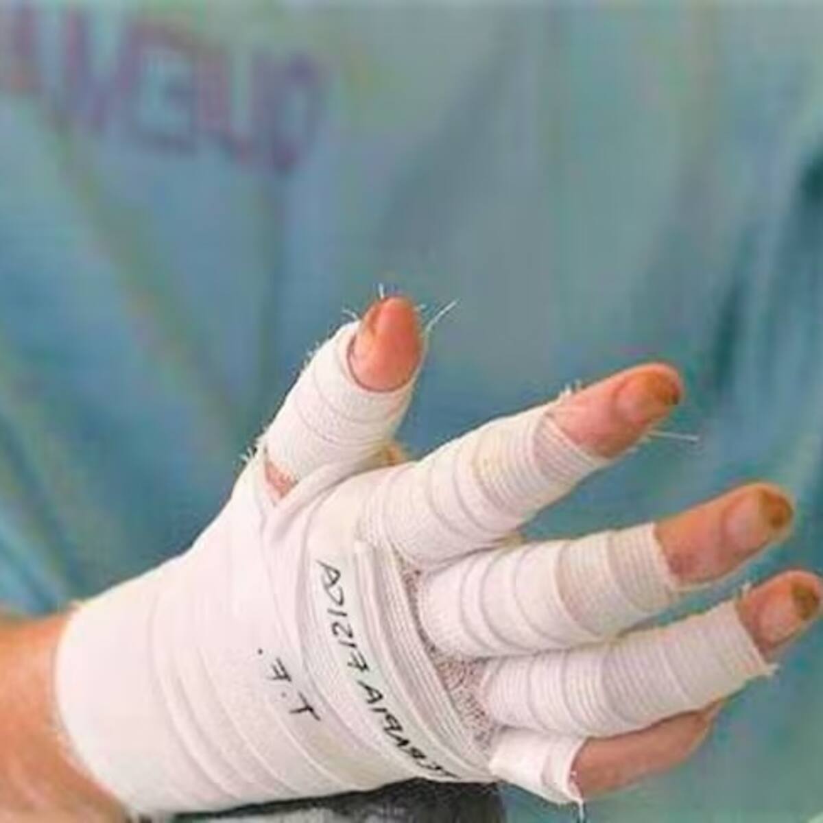 Caldas ya completó 13 personas lesionadas por pólvora en lo corrido de diciembre de 2025