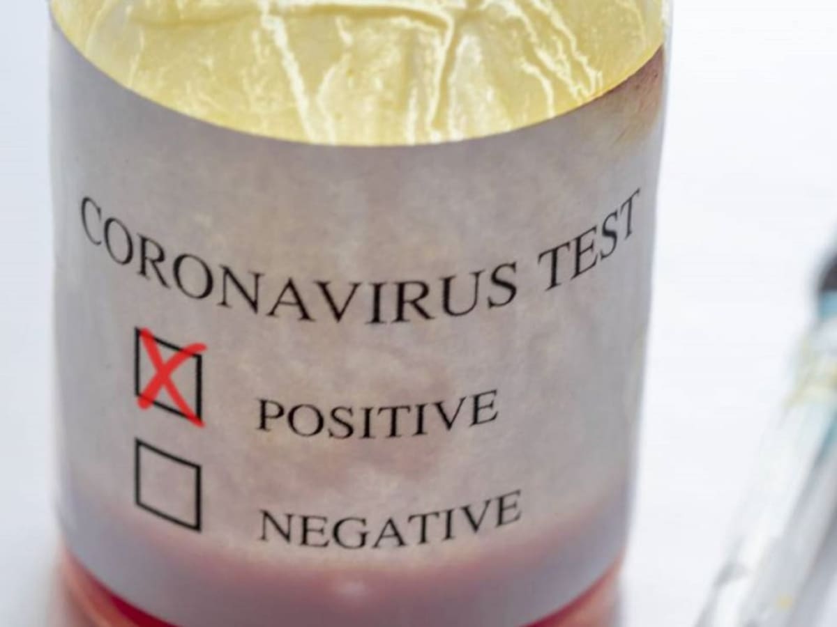 Universidad de Antioquia aisló el Virus SARS-CoV-2