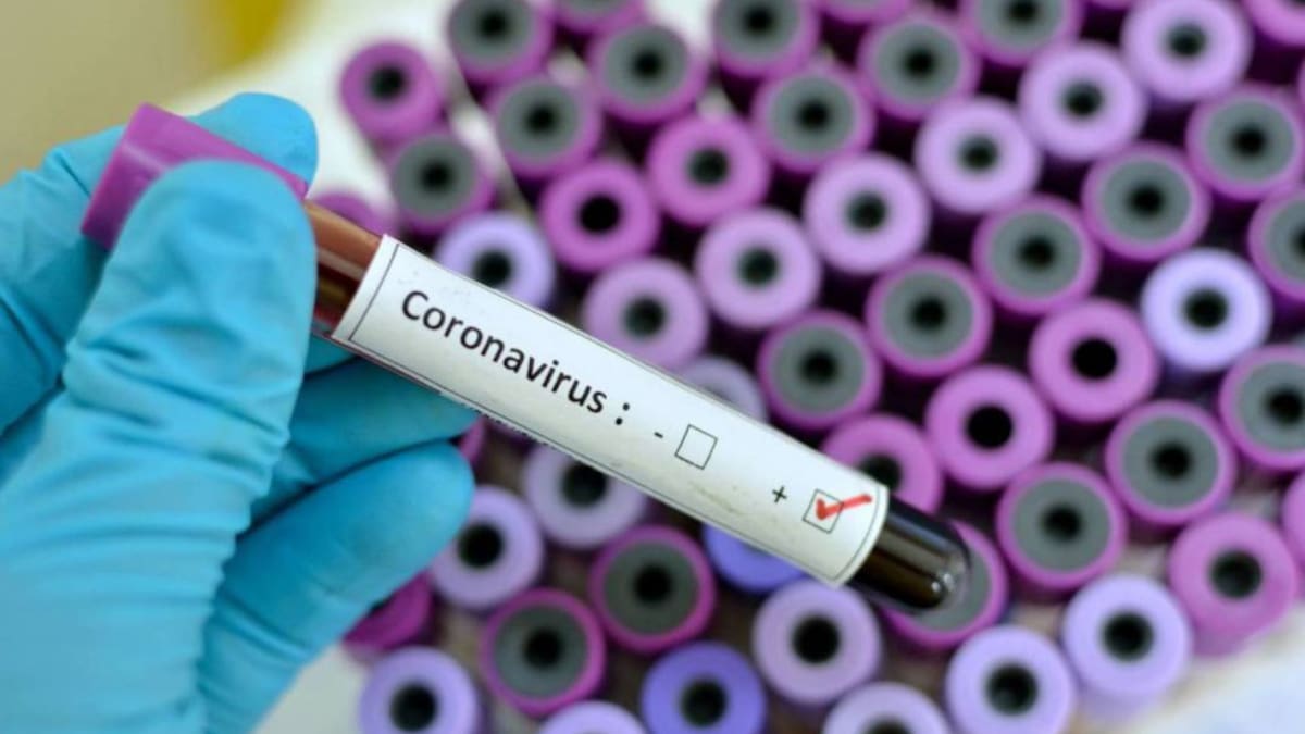 En Risaralda se instaló sala de crisis y vigilancia al coronavirus