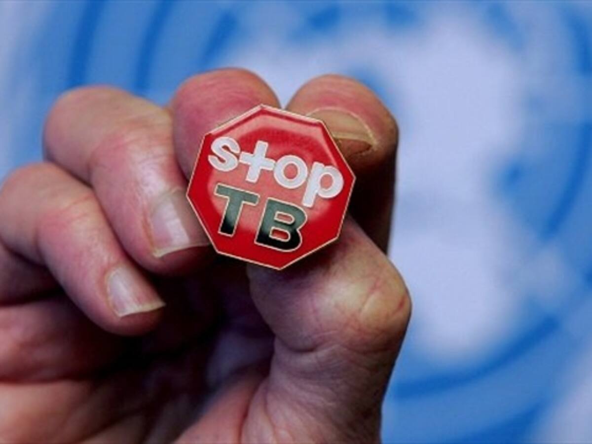 Tuberculosis resistente a los medicamentos, un problema en Colombia
