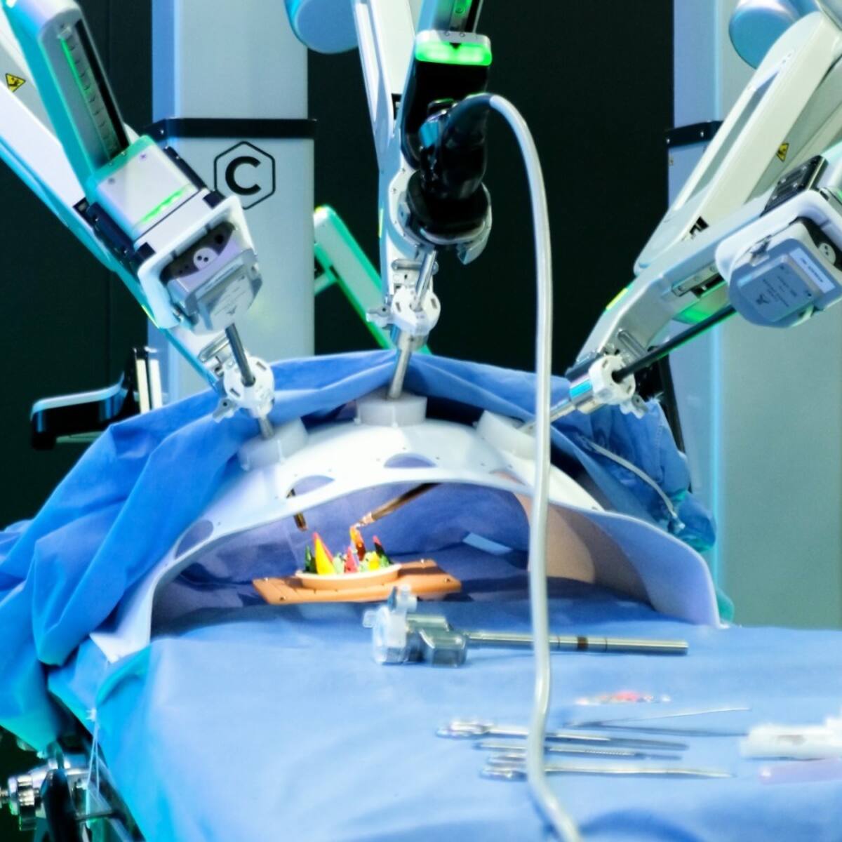 Robot realizará cirugías en hospital de Bucaramanga:así operará una de las tecnologías más avanzadas