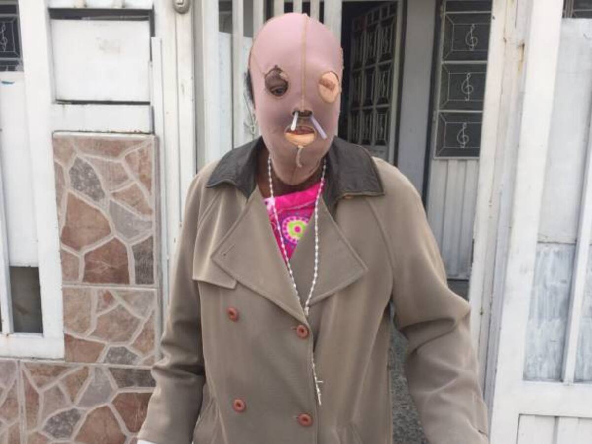 Mujer quemada con ácido tuvo un encuentro con el papa y decidió vivir