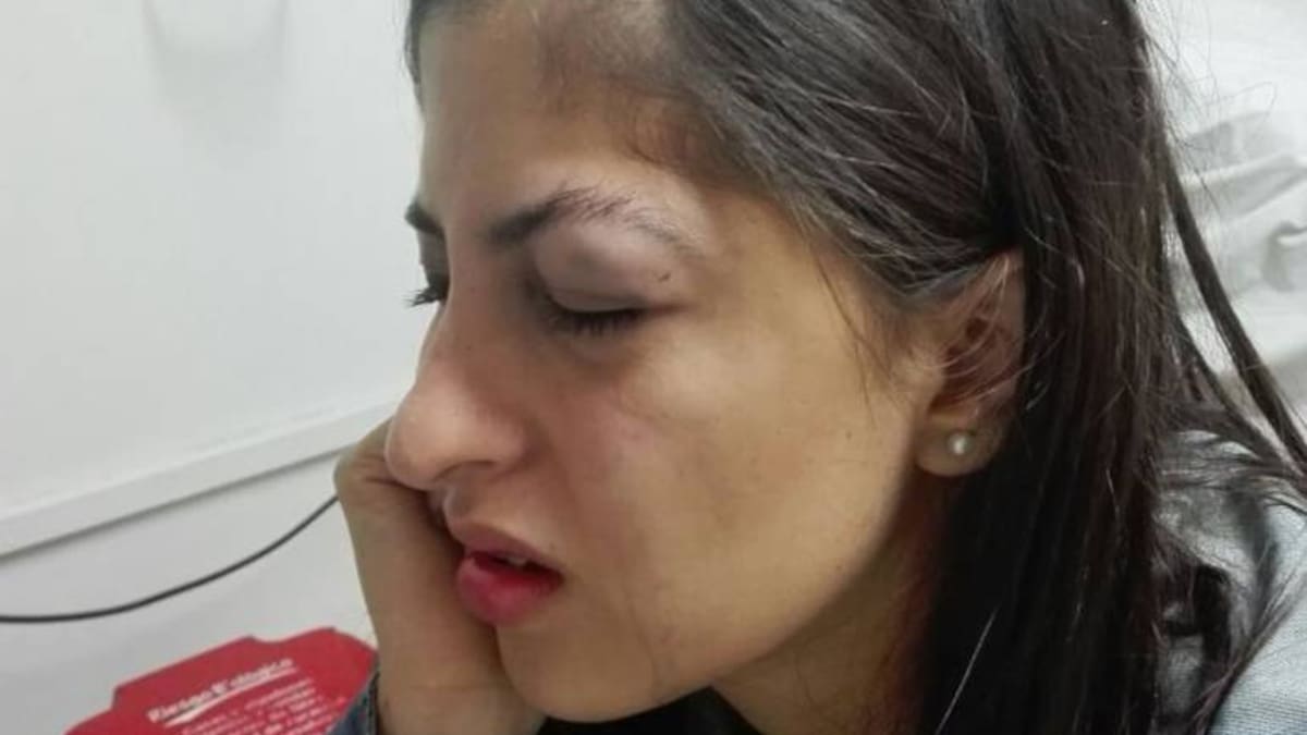 En Armenia hombre golpea una mujer al reclamar por tocarle la cola