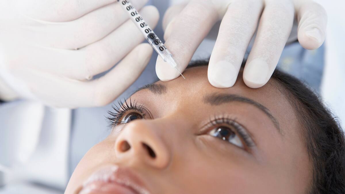 Bótox temprano para prevenir líneas de expresión: ¿qué dicen los expertos?