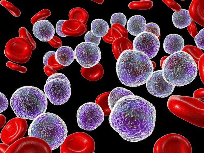 ¿Qué es la anemia de células falciformes?