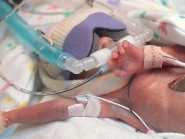 Bebé de 6 días de nacida al borde de la muerte por negligencia médica