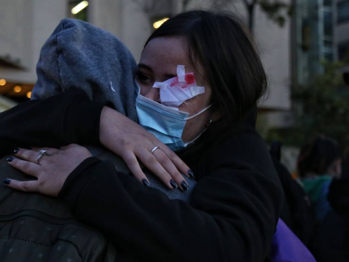 “Van 90 personas con lesiones oculares durante las protestas”