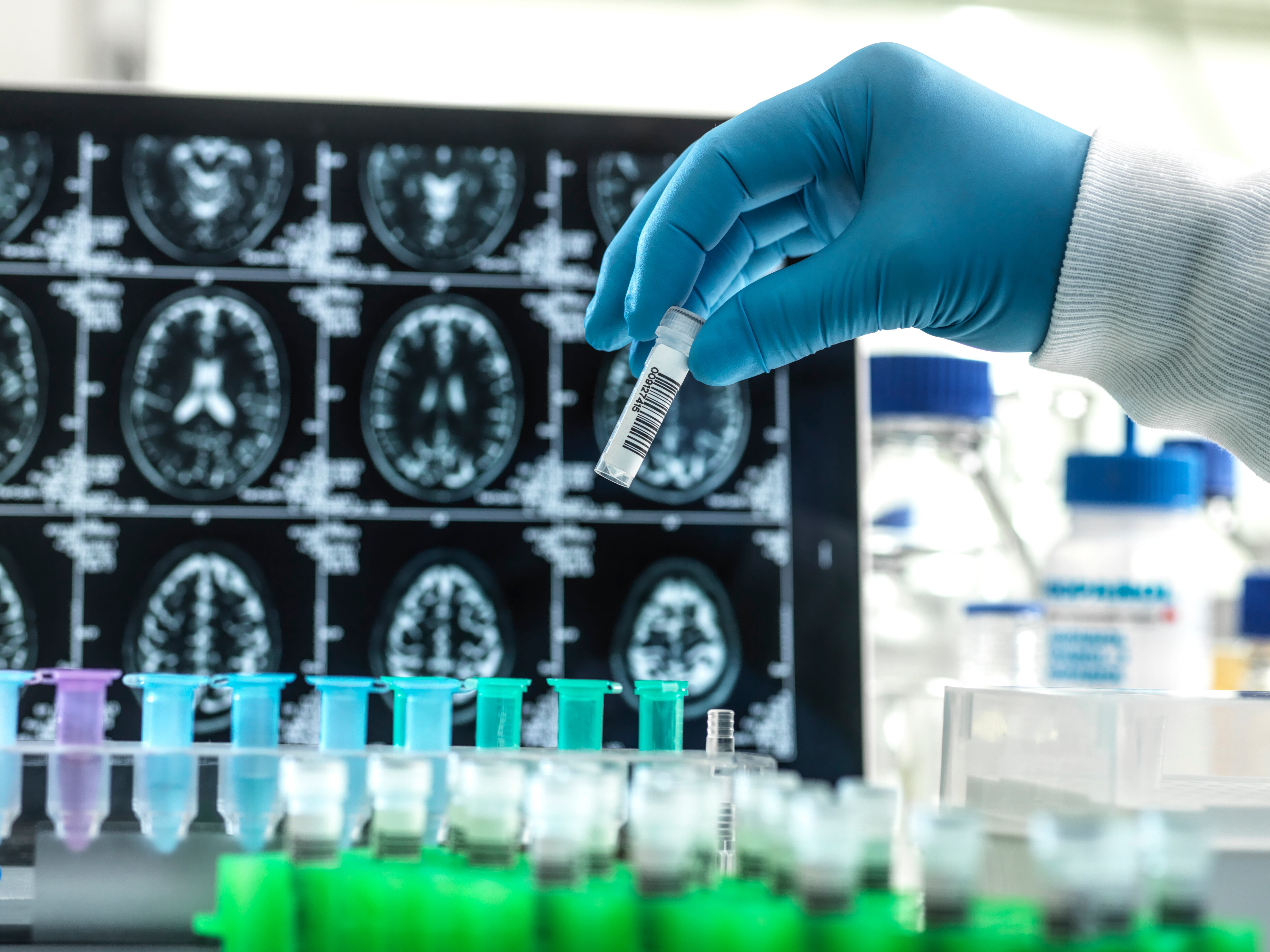 Imagen de referencia. Foto: Getty Images