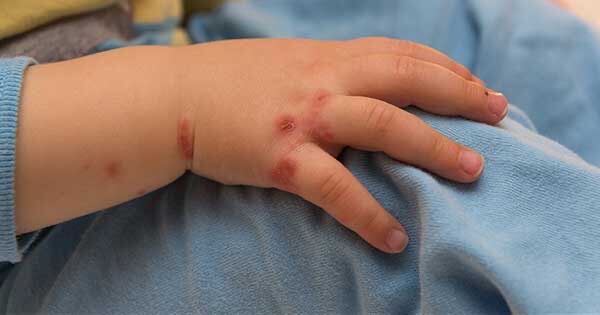 Fotografía suministrada: Alcaldía de Dosquebradas