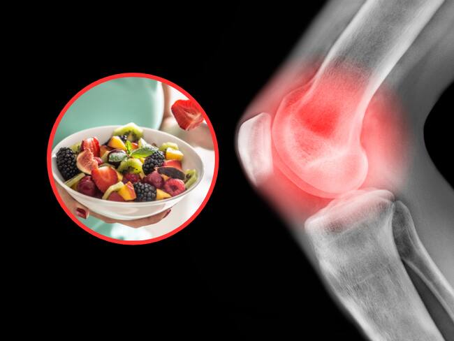 Ilustración del dolor causado por la artritis y de fondo un plato con diversas frutas (Fotos vía Getty Images)