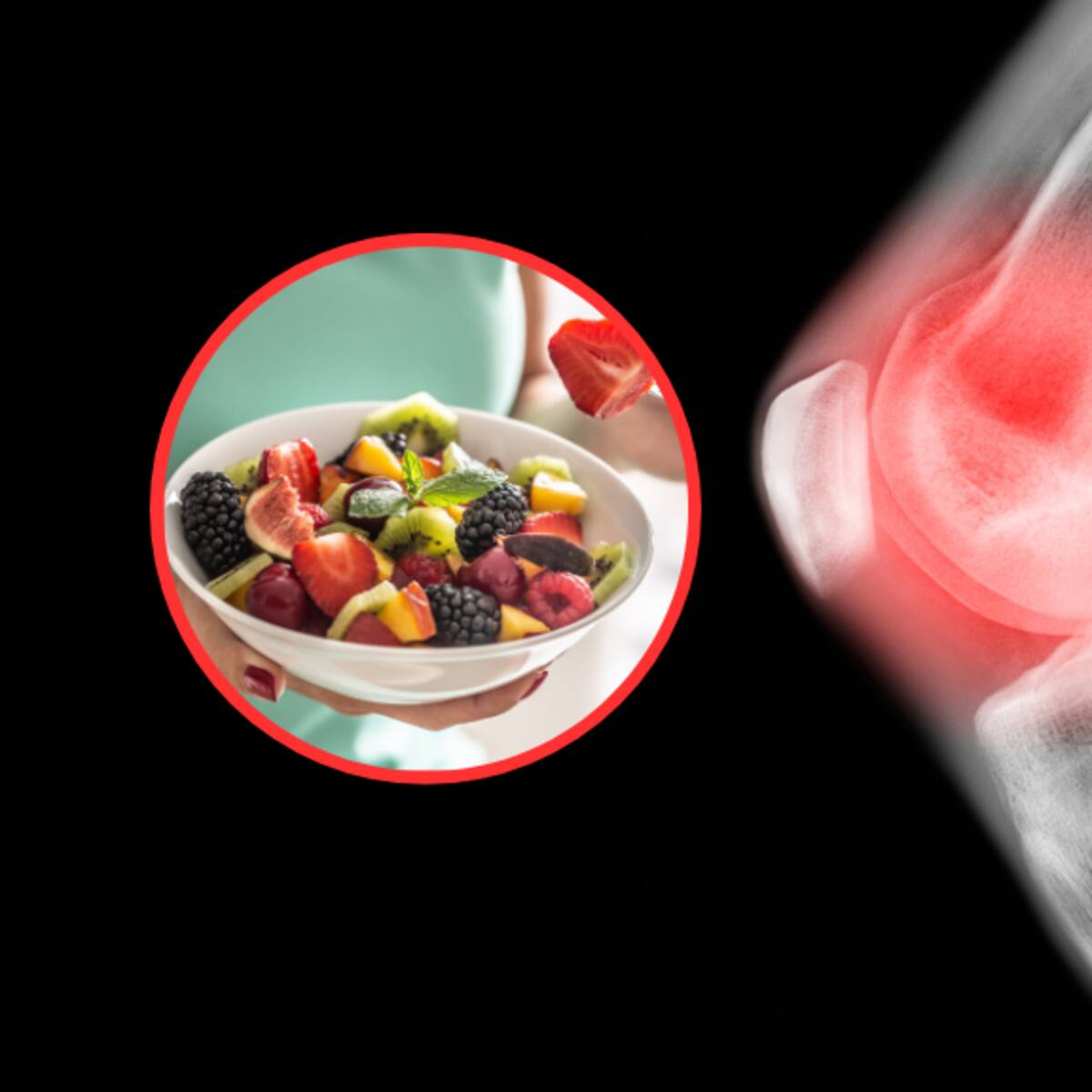 Estas son las frutas colombianas que ayudan a prevenir la artritis