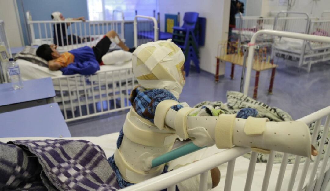 Quemados con pólvora