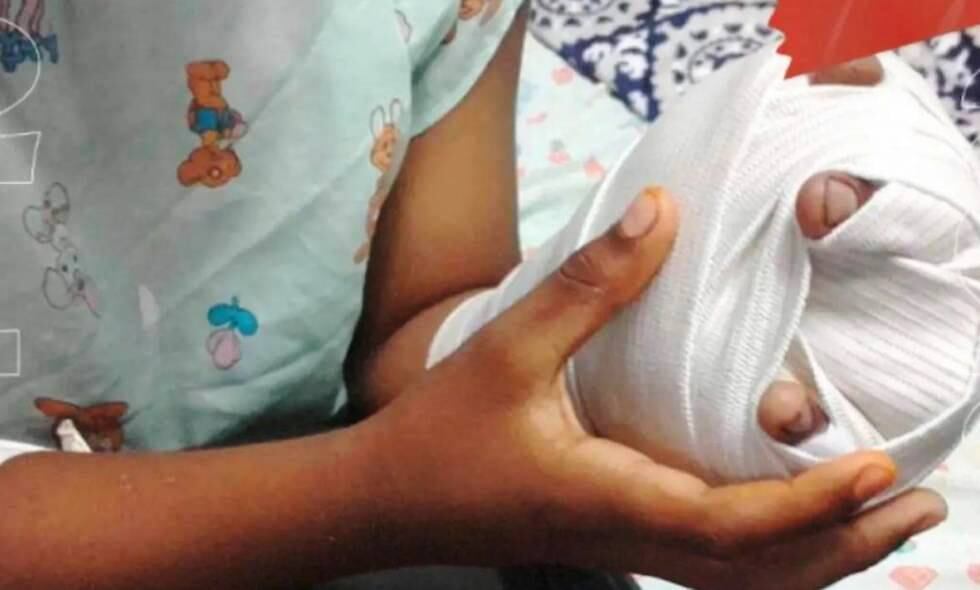 Cartagena reporta tres quemados en celebración de Noche de las Velitas