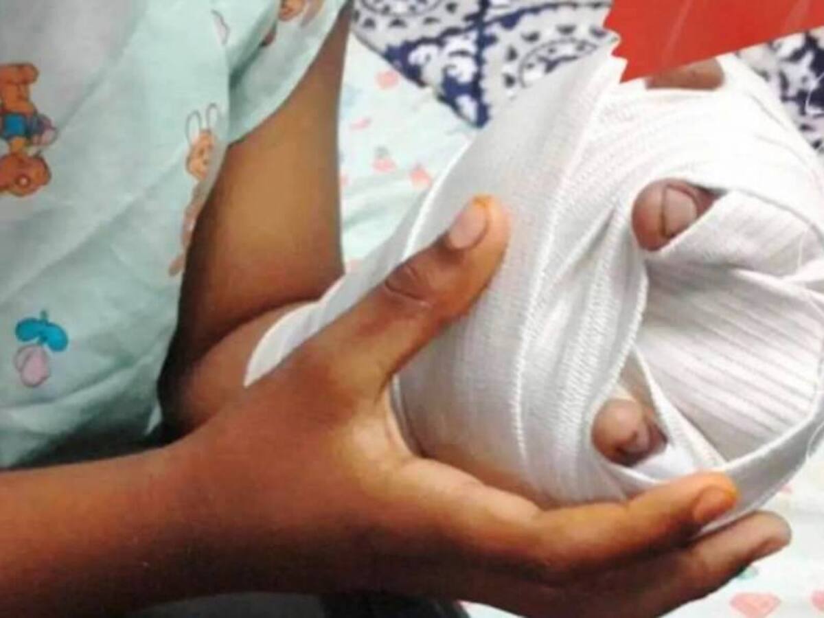 Cartagena reporta tres quemados en celebración de Noche de las Velitas