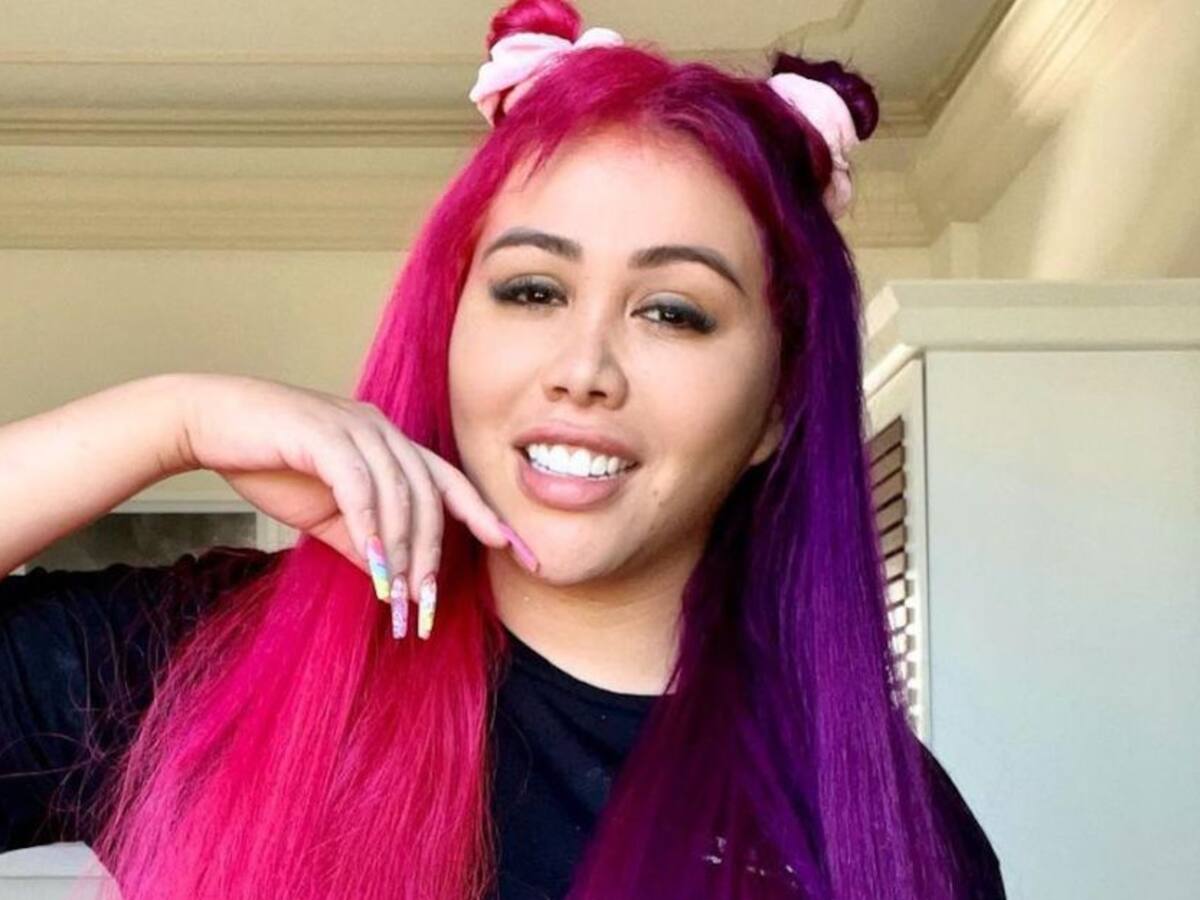 "A mí no me avergüenza", Yina Calderón enseñó cicatríz de sus glúteos