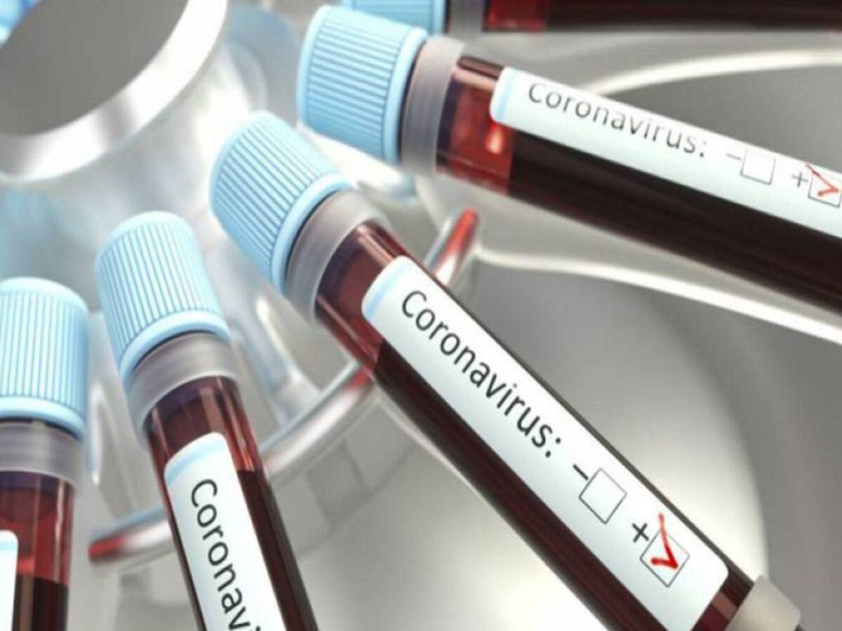 1.273 nuevos contagios de COVID-19 este sábado y 59 muertos en Atlántico