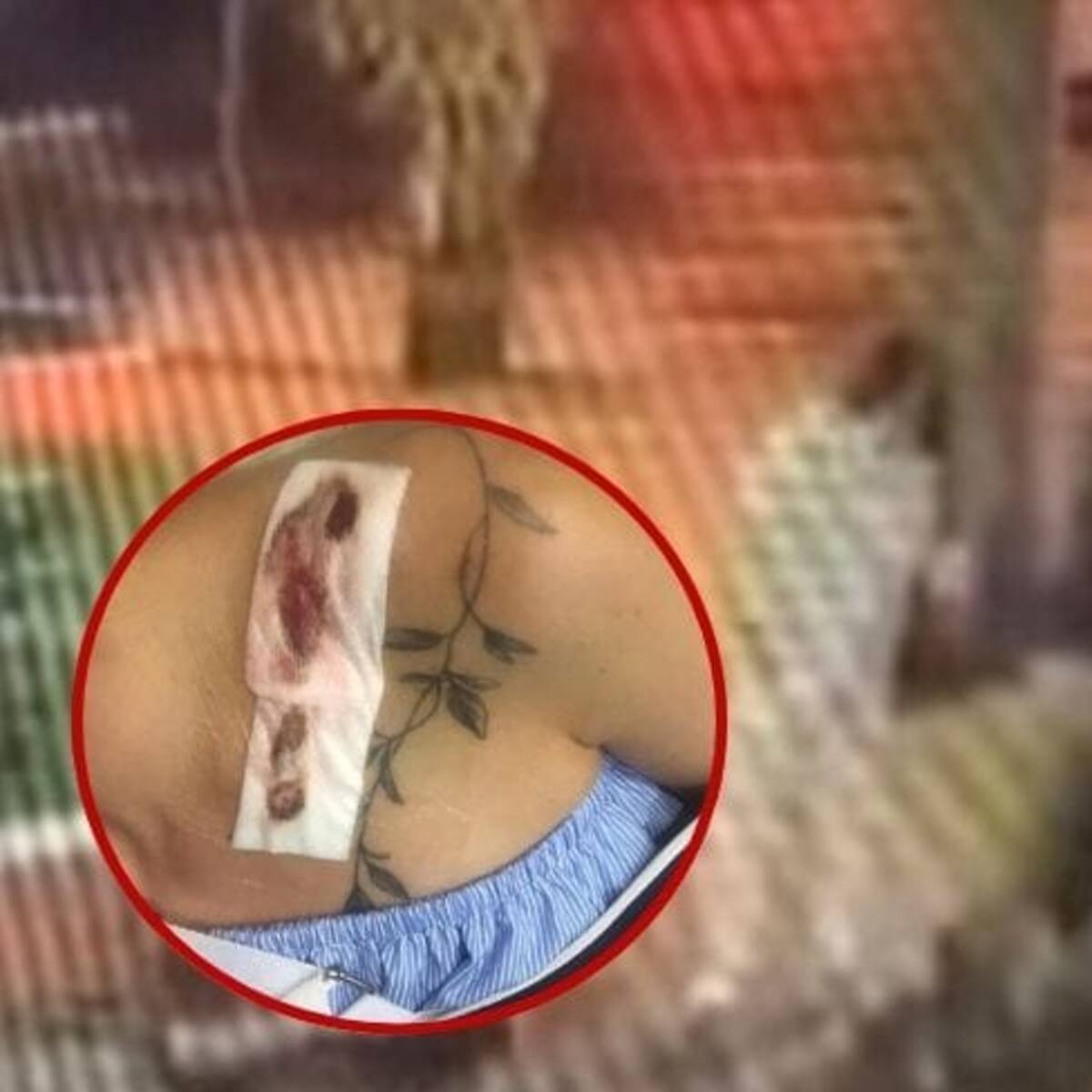 Una mujer denunció agresión física en medio de una pelea entre perros en Armenia