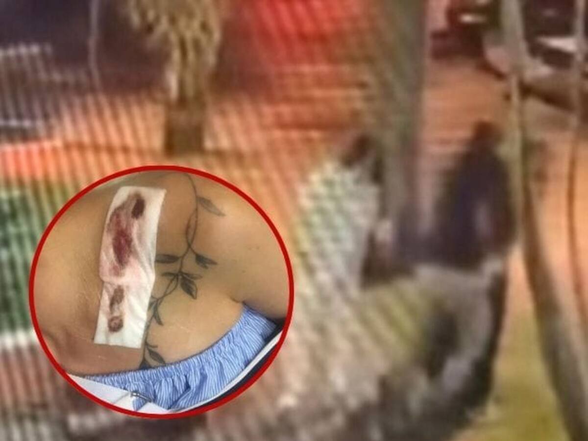 Una mujer denunció agresión física en medio de una pelea entre perros en Armenia