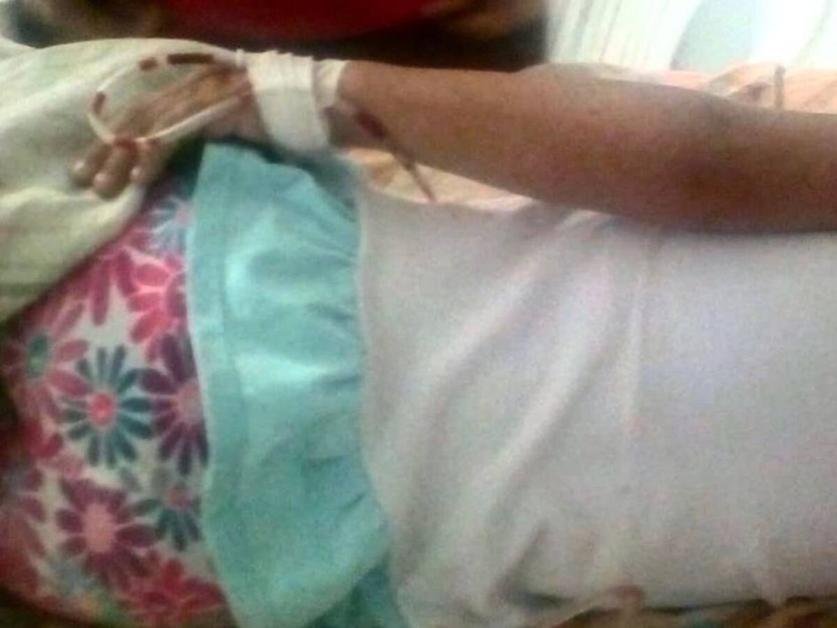 Niña de 4 años completa 48 horas con un objeto extraño en su garganta