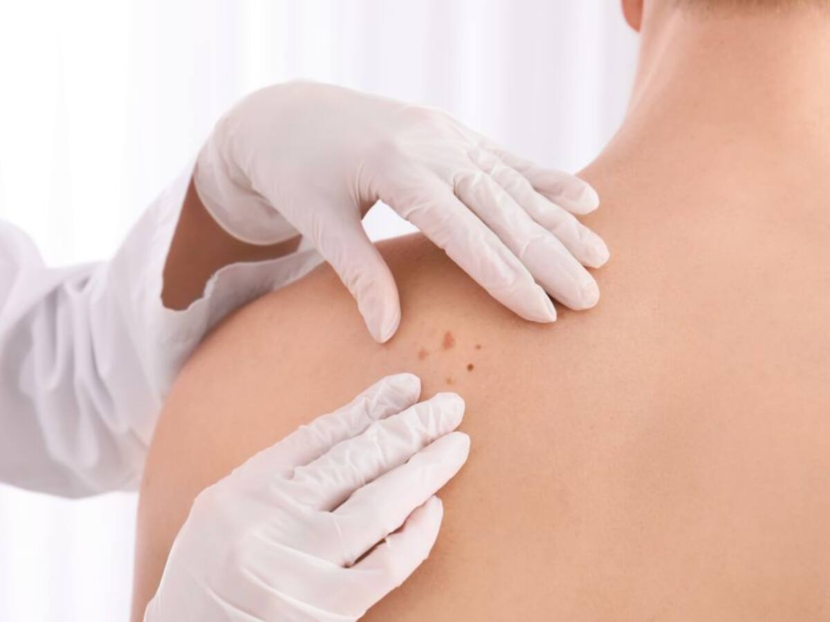 ¿Cuáles son sus factores de riesgo y cómo evitarlo?