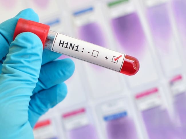 En Cúcuta aumentan casos de AH1N1