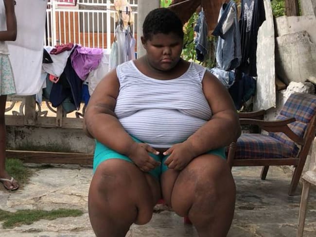 Operarán a Harrinson, el niño más obeso de Colombia que vive en Cartagena