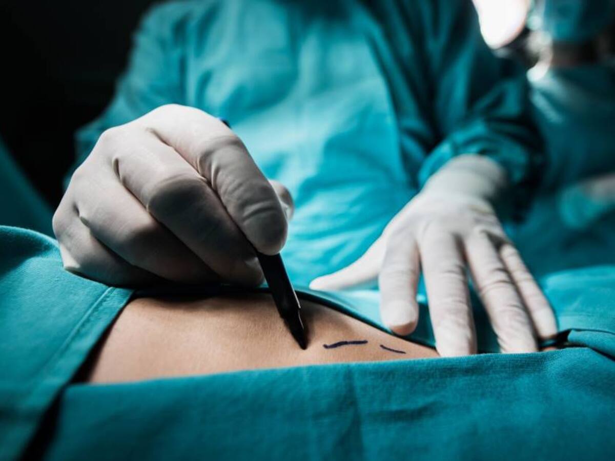 Cirujanos plásticos deben verificar las sustancias que inyecten a pacientes: Corte