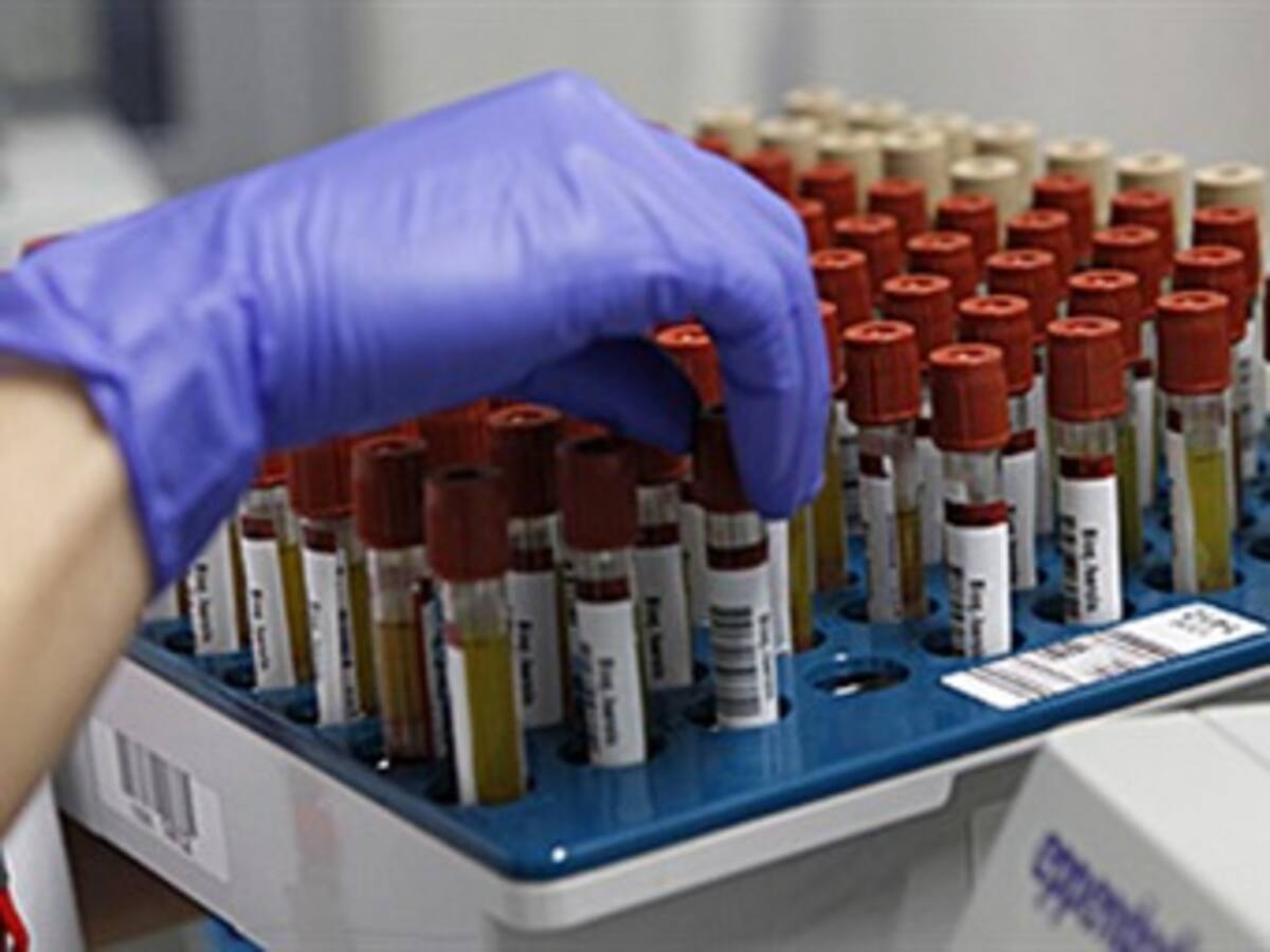 En alerta autoridades de salud del Quindío ante el incremento en casos de Sida
