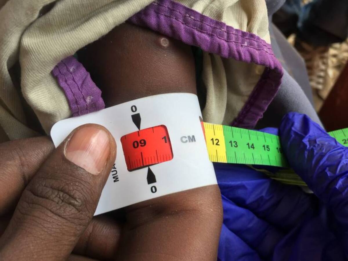 4 de cada 10 latinoamericanos vive en riesgo de seguridad alimentaria: ONU