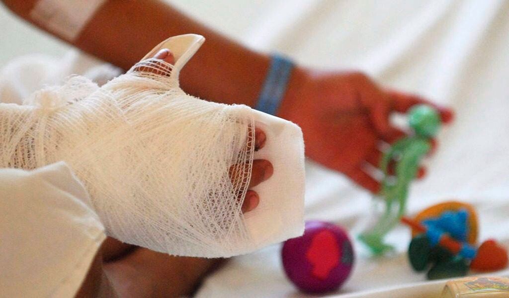 Un total de 18 niños y 5 niñas, se vieron afectados en diciembre de 2024 por el uso indebido de pólvpora en el Valle.