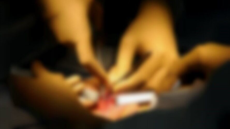 En Córdoba intervienen extraño caso de un hombre que completó nueve días con erección. Foto: Getty Images