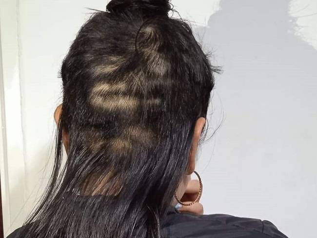 Adolescente de 17 años de edad fue víctima del hurto de gran parte de su cabello 